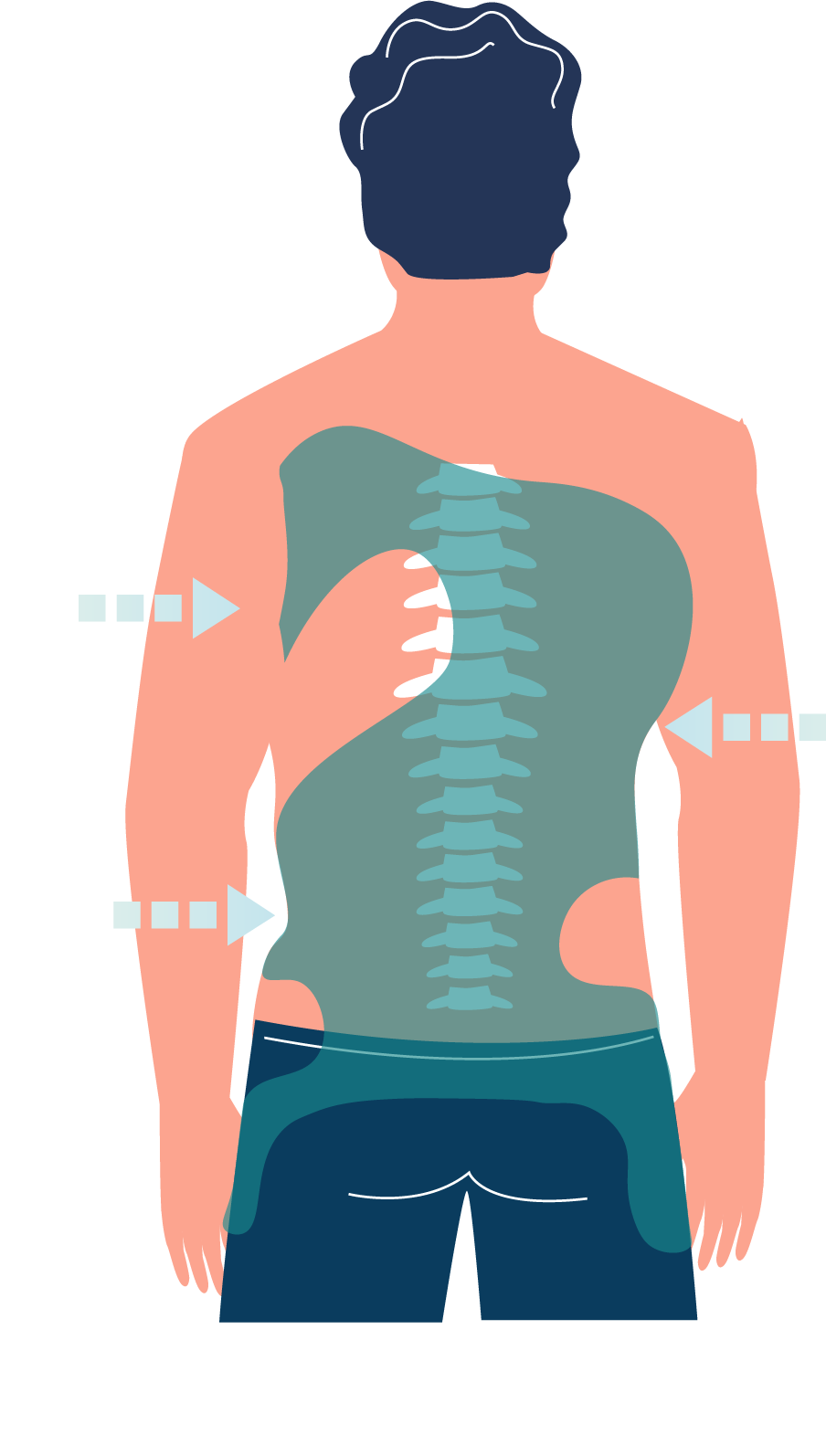 Grafika ilustrująca działanie gorsetu na kręgosłup